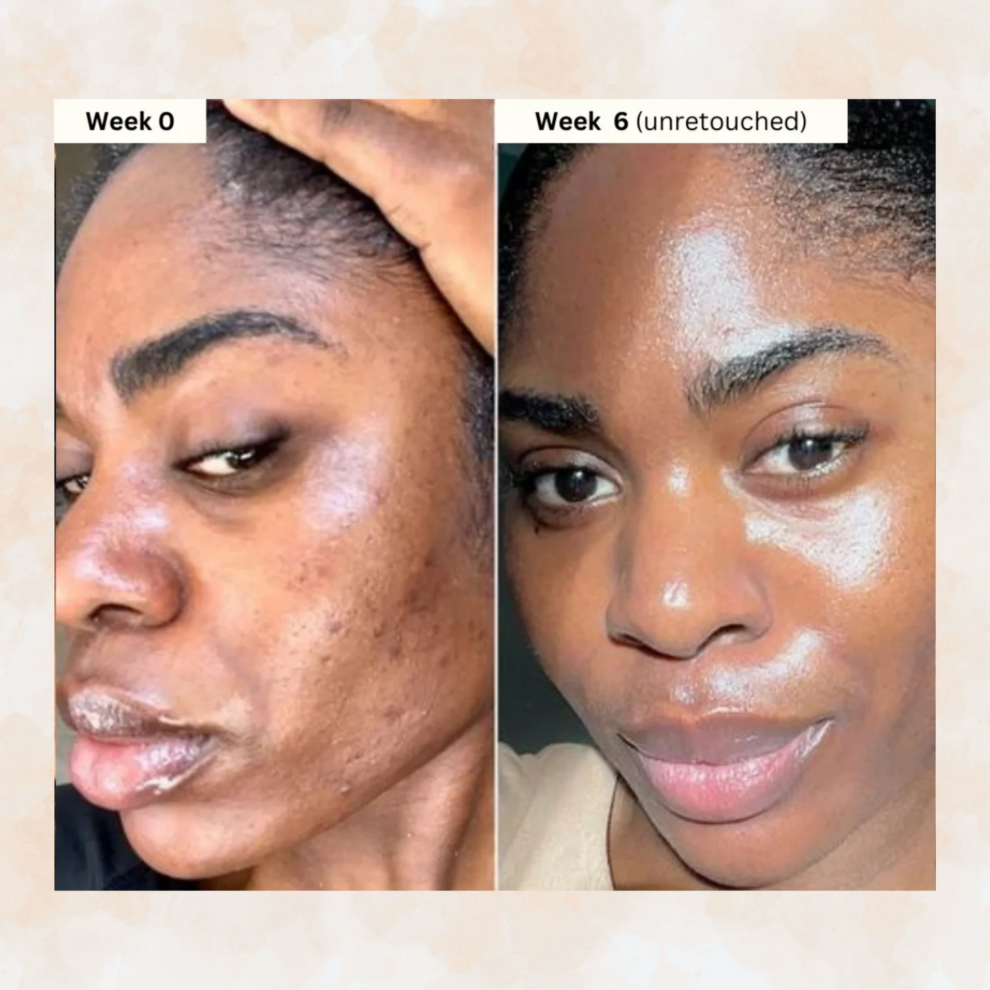 Turmeric & Kojic - Brightening Soap for Clear, Even-Toned Skin