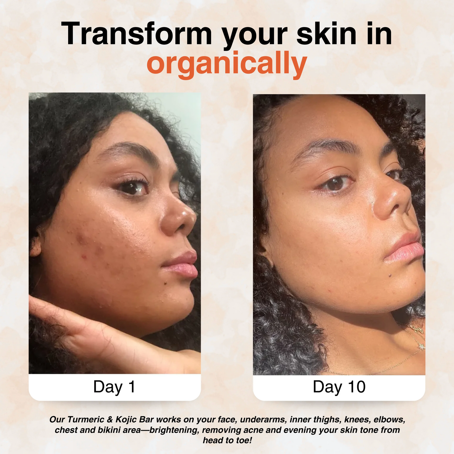 Turmeric & Kojic - Brightening Soap for Clear, Even-Toned Skin