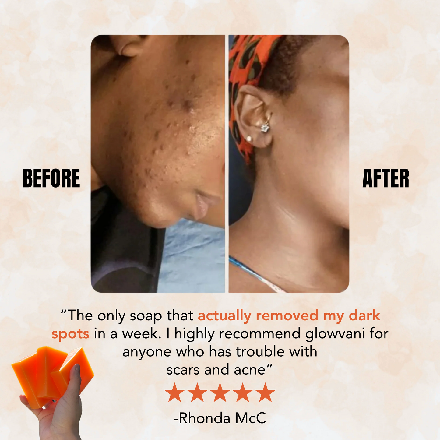 Turmeric & Kojic - Brightening Soap for Clear, Even-Toned Skin