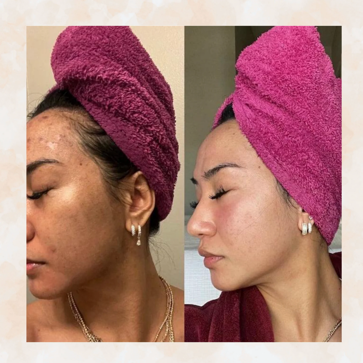 Turmeric & Kojic - Brightening Soap for Clear, Even-Toned Skin